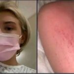 Las Picazones Inesperadas: ¿Alergia o Algo Más Serio?