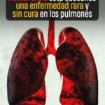 LA AMENAZA DE UNA ENFERMEDAD PULMONAR RARA E IRREVERSIBLE