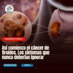 Todo lo que Necesitas Saber sobre el Cáncer de Tiroides: Síntomas y Remedios Naturales