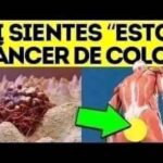 Reconociendo los Síntomas del Cáncer de Colon: Guía Completa
