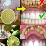 Cómo Blanquear los Dientes de Forma Natural con Jengibre y Bicarbonato