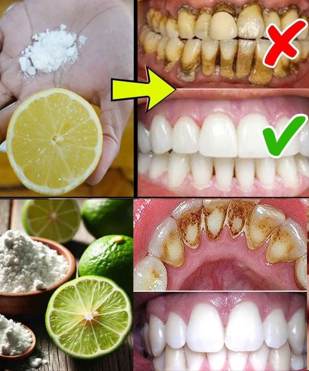 Remedio casero blanqueamiento dental con jengibre, limón y bicarbonato