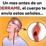 Señales de Alerta: ¿Qué Mandan Tu Cuerpo Un Mes Antes de un Derrame Cerebral?