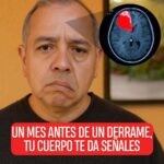 Señales que da el cuerpo antes un derrame
