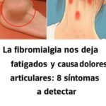 La fibromialgia nos causa fatiga y dolores articulares