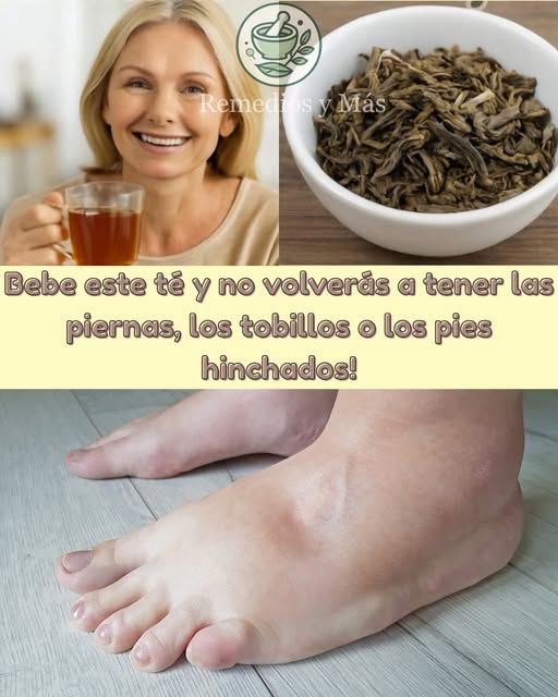 Té natural para reducir hinchazón