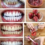 Blanqueamiento Dental Casero: Cómo Blanquear tus Dientes en Casa con Solo 2 Ingredientes