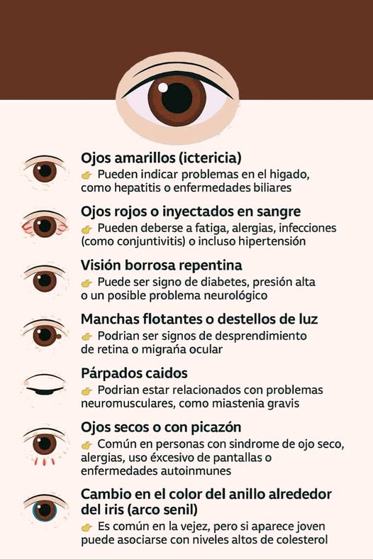 Infografía sobre salud ocular