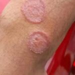 Signos que Indican que Estás en Proceso de Curación y Remedios Naturales