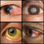Signos de Problemas Oculares: ¿Cuándo Debes Ir Urgentemente al Médico?