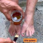Rompe Hongos: El Remedio Natural que Rejuvenece tus Pies