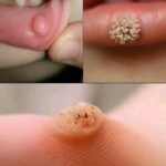 Primeros Signos de Afecciones Cutáneas: Identificación y Remedios Naturales