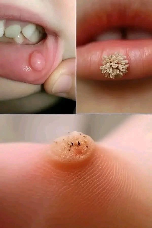 Afecciones cutáneas en el cuerpo humano