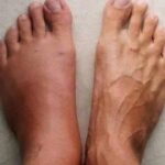Las 7 Señales de Advertencia de un Infarto: Presta Atención a Tu Cuerpo