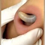 Remedios Caseros y Naturales: La Guía Completa para Mejorar tu Salud