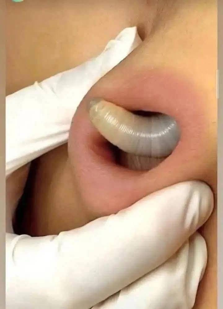 Remedios Naturales