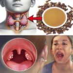 El Clavo de Olor: Tu Antibiótico Natural para Aliviar el Dolor de Garganta