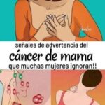 Síntomas Comunes del Cáncer de Mama: ¡Detecta a Tiempo!