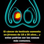 Prevención del Cáncer de Testículo en Jóvenes: Remedios Naturales y Hábitos Saludables