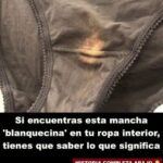 ¿Manchas Blanquecinas en la Ropa Interior? Lo Que Debes Saber