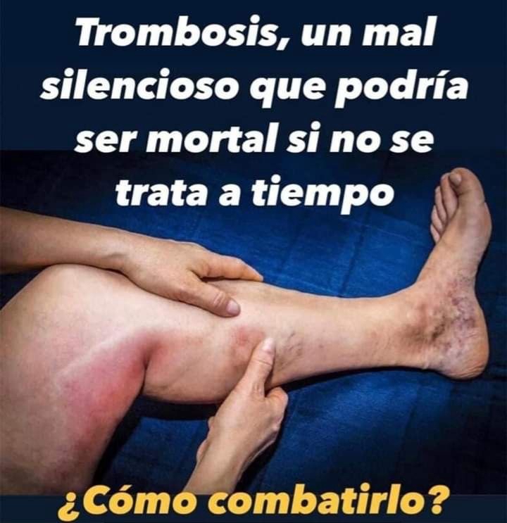 Síntomas de Trombosis