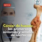 Señales Iniciales del Cáncer de Huesos: Lo Que Debes Saber
