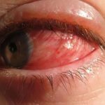 Consecuencias de Dormir con el Maquillaje: Cuida tus Ojos con Remedios Naturales