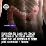 Síntomas del Cáncer de Colon en Jóvenes: Cómo Detectarlo a Tiempo
