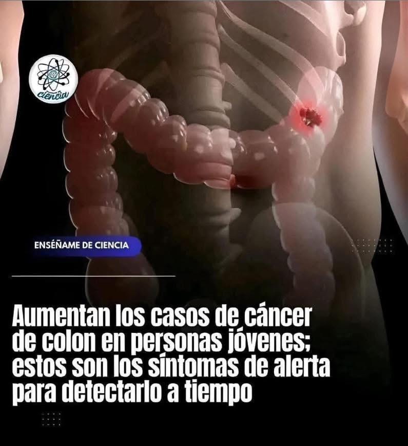 Ilustración del sistema digestivo y cáncer de colon