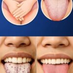 ¿Qué Significa Tener la Lengua Blanca? Causas y Remedios Naturales
