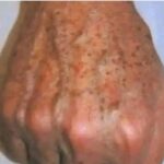 Señales en tus Manos que Indican Problemas de Salud: Cuidados y Remedios Naturales