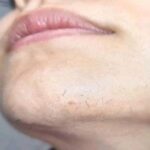 Remedios Caseros y Naturales para el Bienestar de la Mujer
