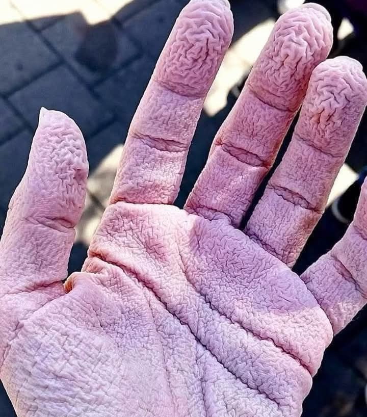 Mano con dedos arrugados