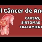 El Cáncer de Ano: Causas, Signos, Síntomas y Tratamientos