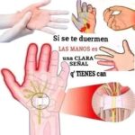 ¿Por qué se te duermen las manos? Causas y Remedios Naturales