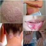 Señales en la Piel que Indican Problemas de Salud: ¿Tienes Papi?