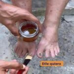 Rompe Hongos Natural: Un Remedio Casero para Cuidar Tus Pies