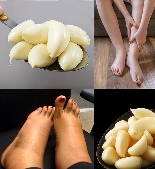 Dientes de ajo y piernas hinchadas