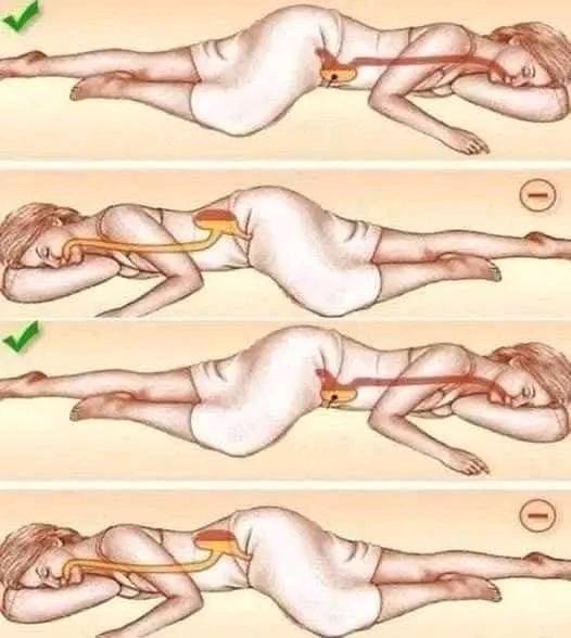 Posiciones para Dormir y Efectos en el Sistema Digestivo