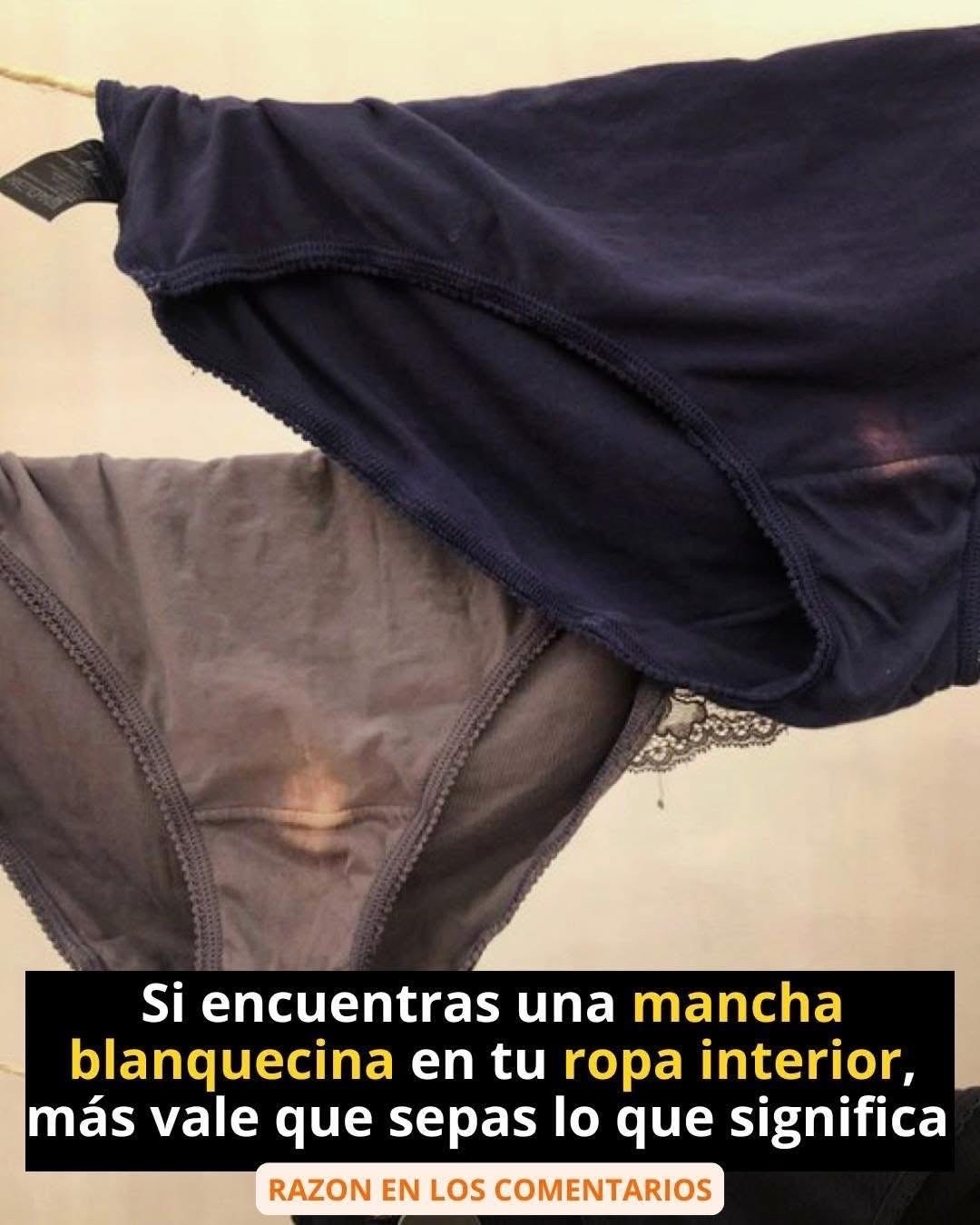 Manchas en ropa interior