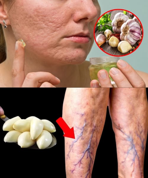 Ajo y sus beneficios para la salud