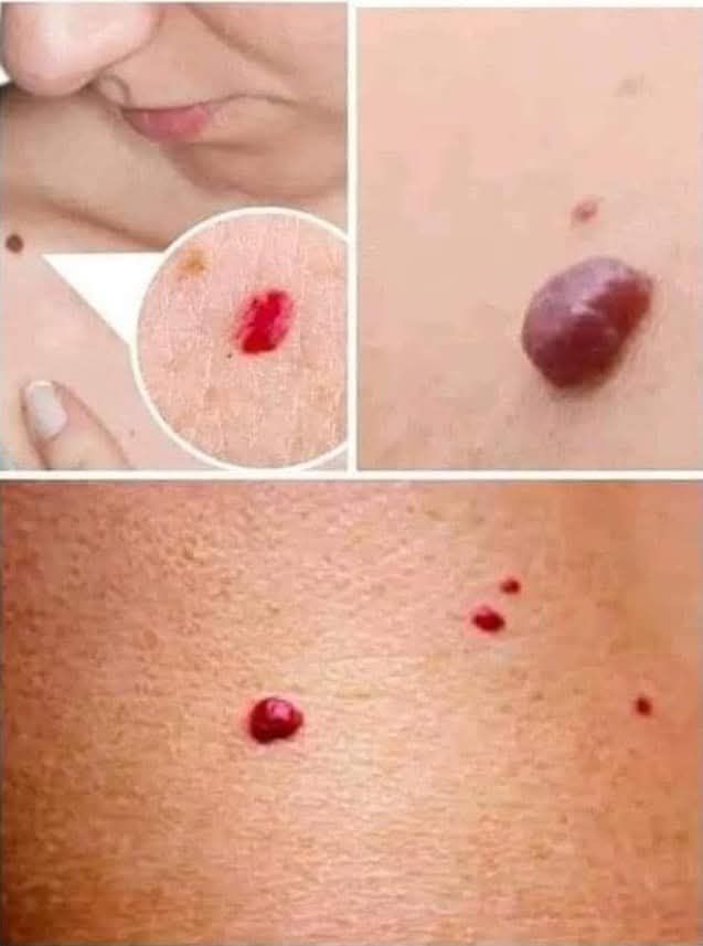 Ejemplos de puntos rojos en la piel
