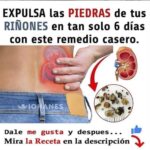 Expulsa las Piedras de tus Riñones de Forma Natural y Efectiva