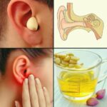 Uso del Ajo y Otros Remedios Naturales para Aliviar el Dolor de Oído