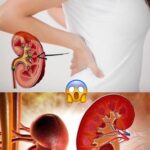 Limpia Tu Sistema Renal: Remedios Naturales y Consejos para una Salud Óptima