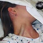 Distensión Yugular Masiva: Un Signo de Alarma Que No Debes Ignorar