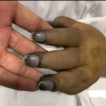 Cuidados de Salud: ¿Por Qué No Debes Pintarte las Uñas Sin Precaución?