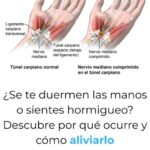 ¿Por Qué Se Te Duermen las Manos? Descubre el Síndrome del Túnel Carpiano y Cómo Aliviarlo Naturalmente