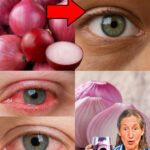 Mejora Tu Vista Naturalmente: Remedio Casero con Cebolla