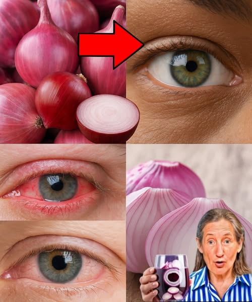 Remedio natural con cebolla para mejorar la vista